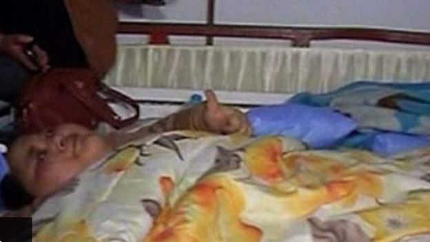 انجاز مدهش للمصرية الاكثر سمنه في العالم