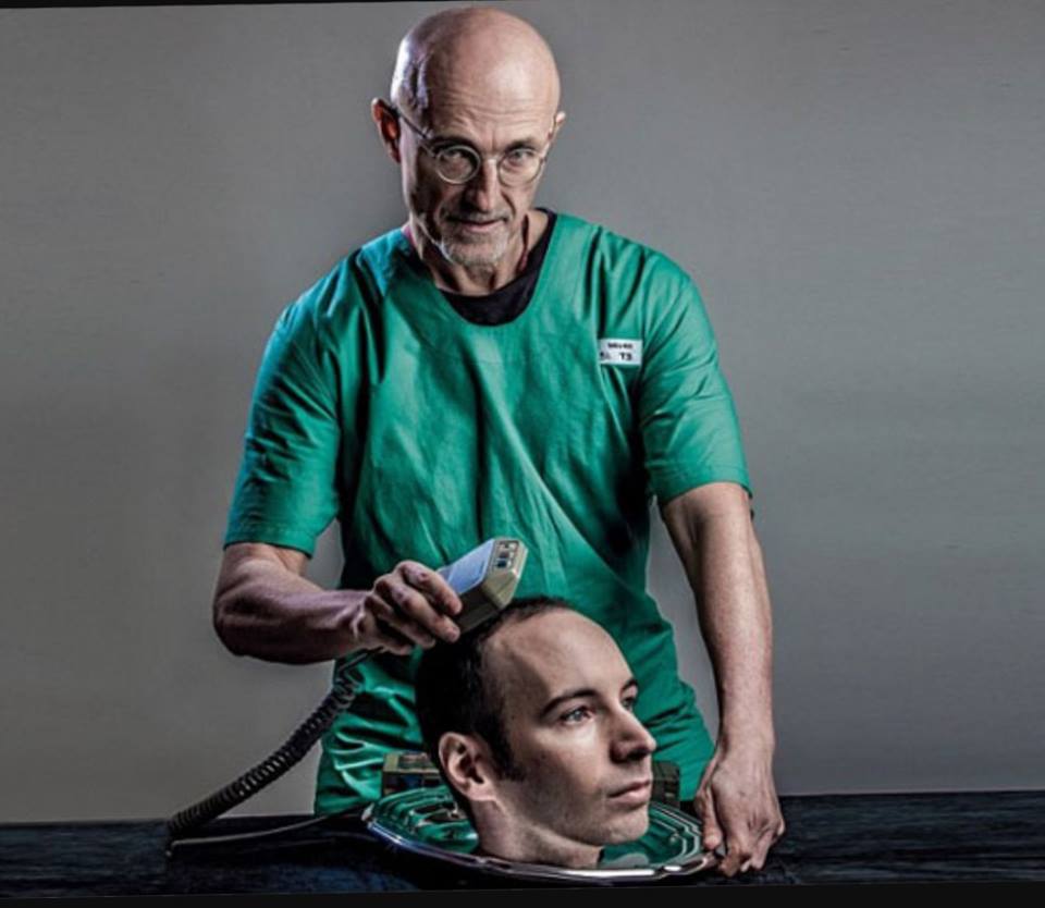 صدق أو لاتصدق إجراء أول عملية زرعٍ للرأس في العالم