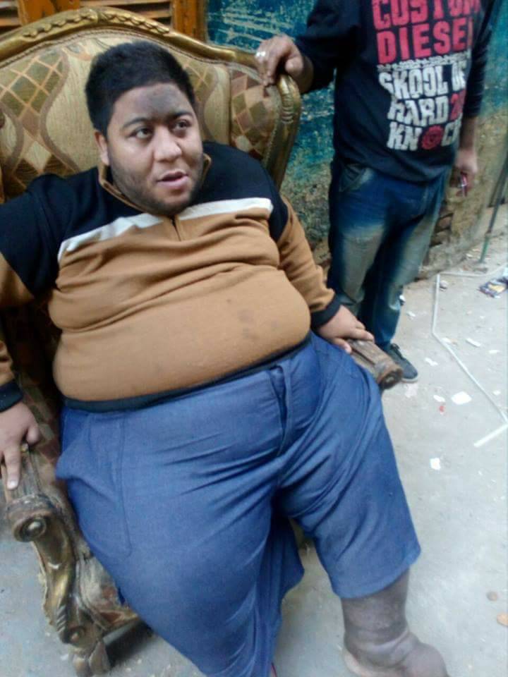 ” محمد الحجاجى” صرف معاش تكافل وكرامة لمريض بالحمرة