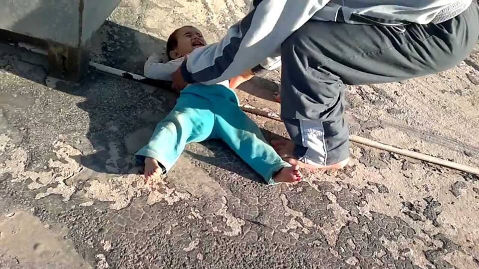 إصابة طفل بكسر بالجمجمة إثر سقوطه من الدور الحادى عشر