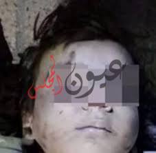 مصرع طفل شنقاً أثناء لعبه بمنزله بالعامرية