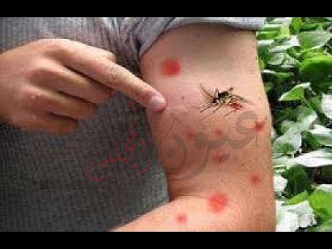 مبادرة للقضاء علي البعوض نهائياً تحت مسمي ساعة الصفر