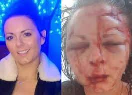 تعرض سائحة بريطانيه لإعتداء وحشي يبدل ملامحها..!