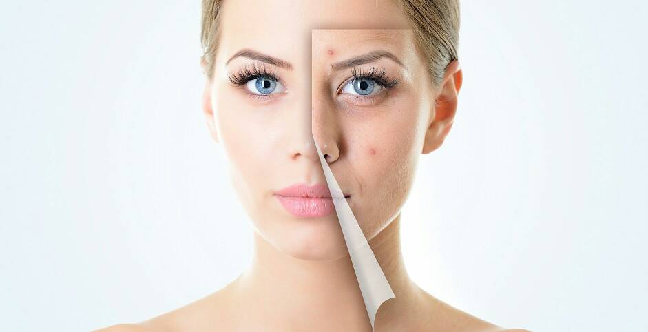 لك سيدتي 5 نصائح لبشرة نضرة وصحية فى فصل الشتاء