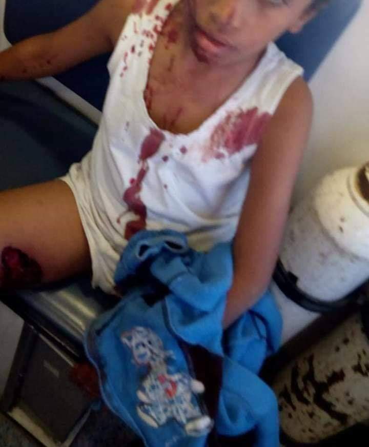 أستهداف أتوبيس للأقباط بالمنيا….