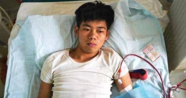 مراهق صيني يبيع كليته من أجل شراء آيفون، ويعيش في معاناة كل يوم