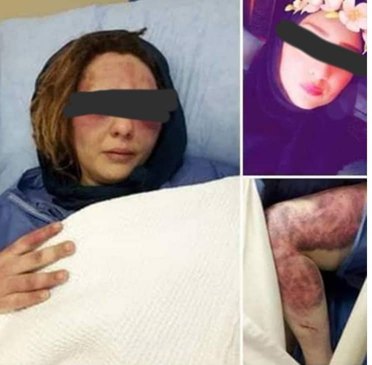 جرائم نفسية ولا آدمية !