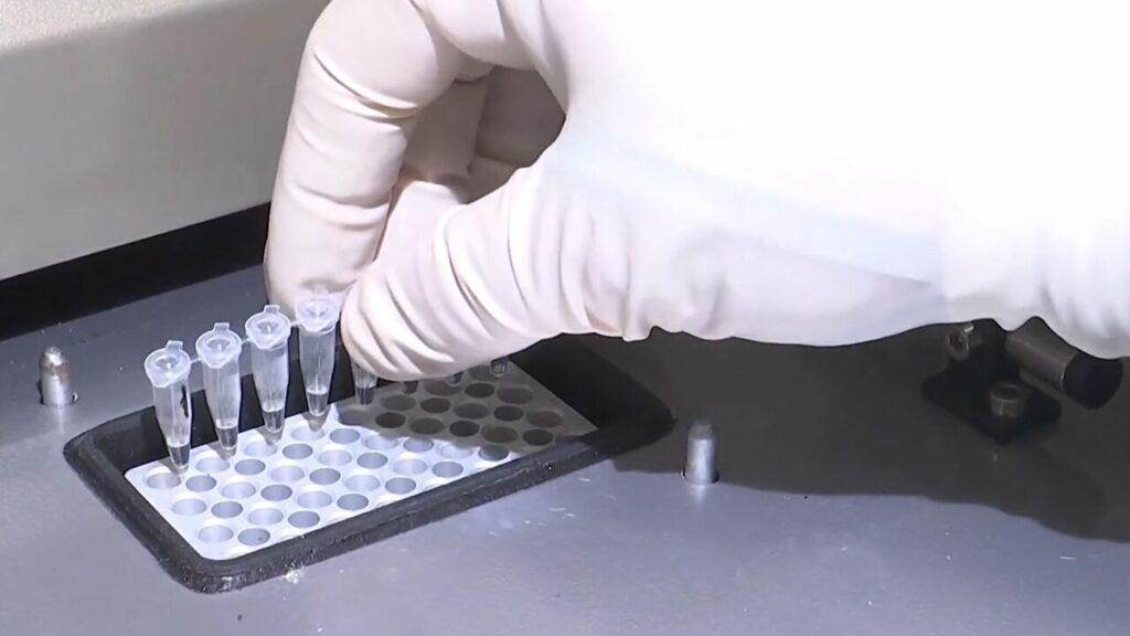 “كوفيد-غلوبولين”… دواء روسي مبتكر لعلاج حالات الإصابة الخطيرة بـ”كورونا”