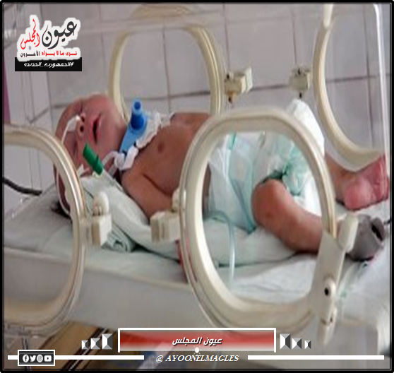 الأمم المتحدة: يوجد 77 مولوداً في 20 حضانة بمستشفى “الهلال الإماراتي” معظمهم أصبحوا يتامى