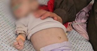 بسبب المجاعة والجفاف.. وفاة الطفلة جنان السكافي بمستشفى الرنتيسي بغزة